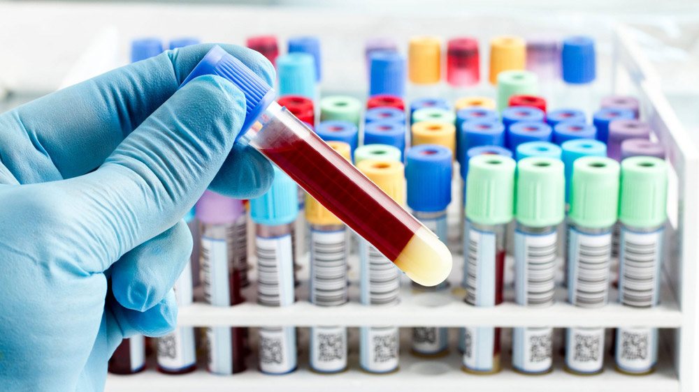 Pathology equipment