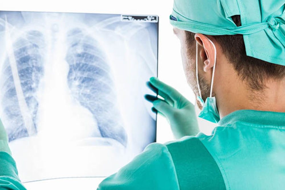 Digital radiography equipment